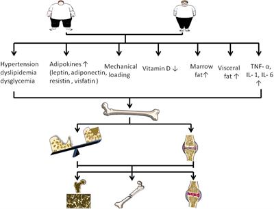 Obesity and Bone Health: A Complex Link